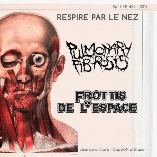 Pulmonary Fibrosis : Respire par le Nez